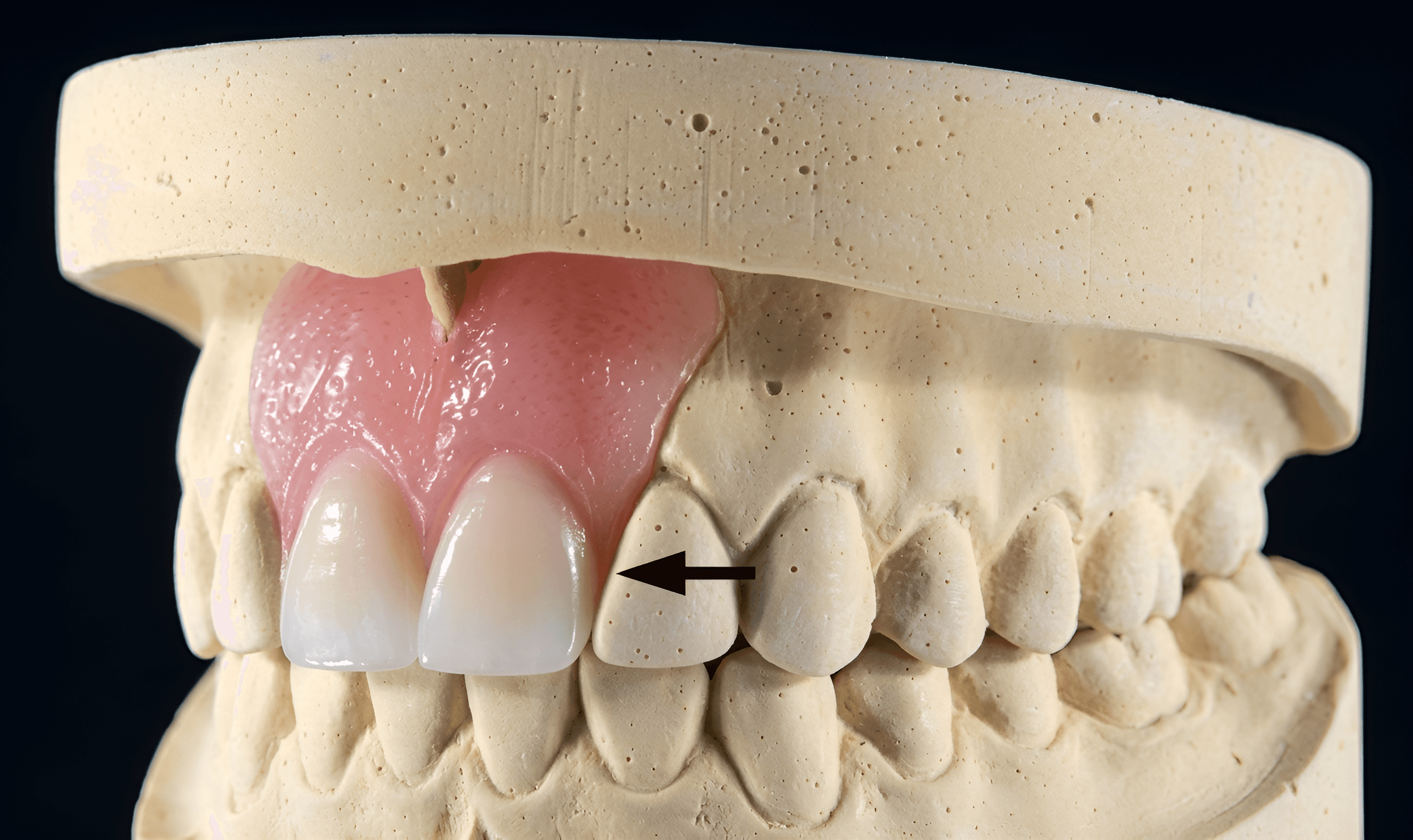After — AI processed result