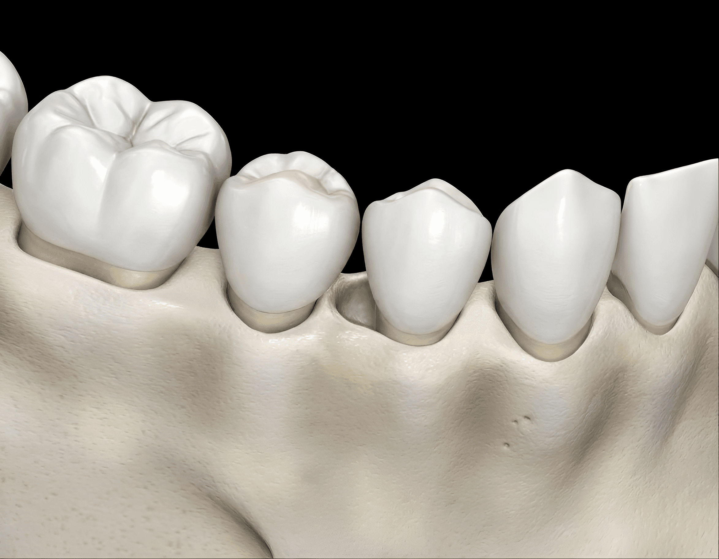 After — AI processed result