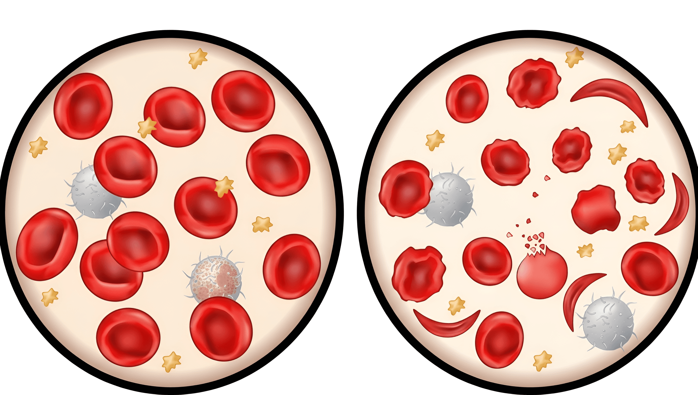 Unveiling Microscopic Detail: AI Enhances Blood Cell Diagram Clarity