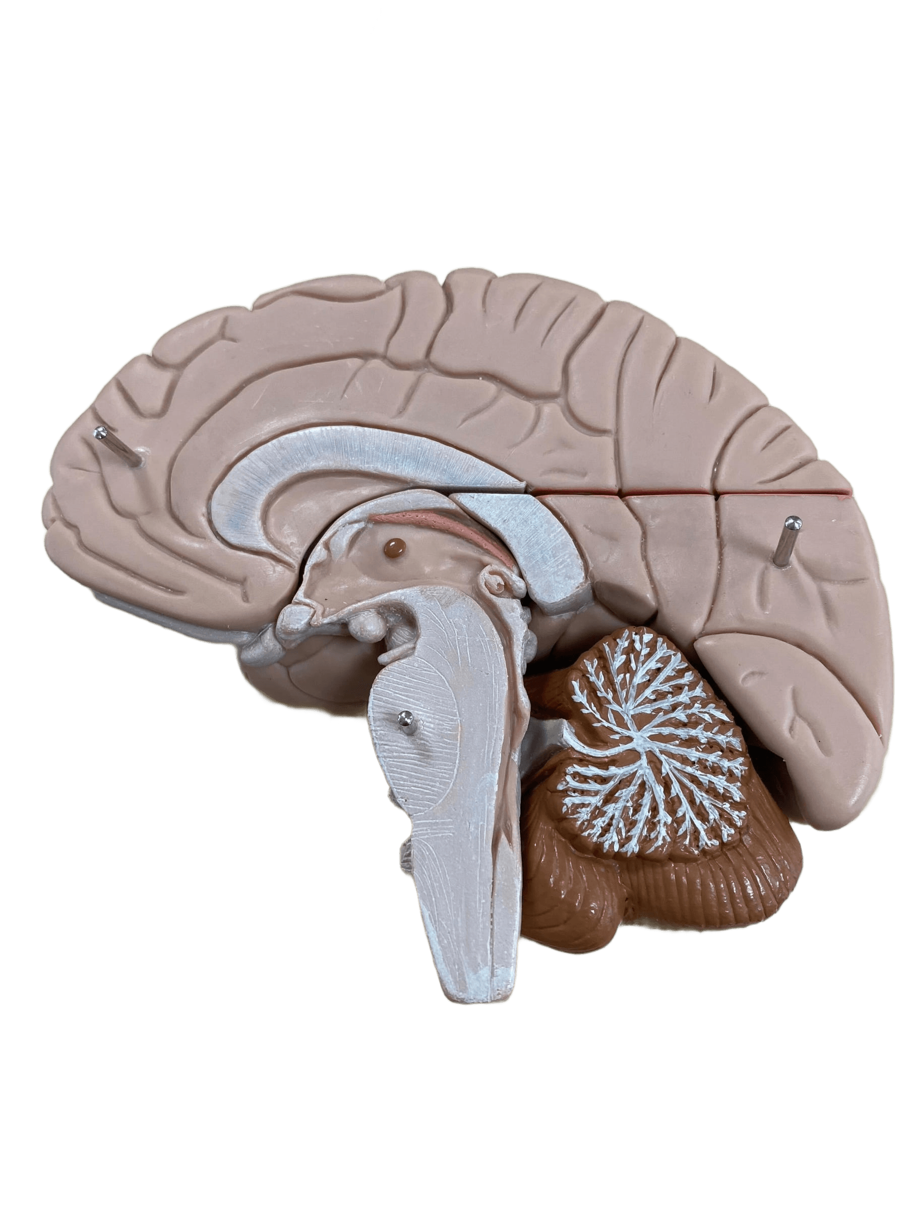 Precision Background Removal for Intricate Anatomical Models